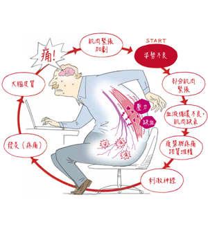 强直性脊柱炎症状是用来判断一种疾病为直观的方式,当某种疾病主要的